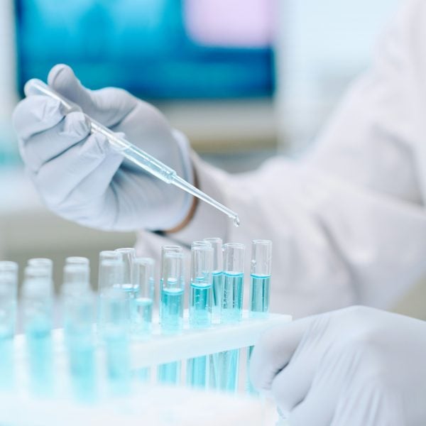 Labor Diagnostik